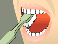 BRUSHING: STEP 3 Brush the outer, inner, and chewing surfaces of each tooth.